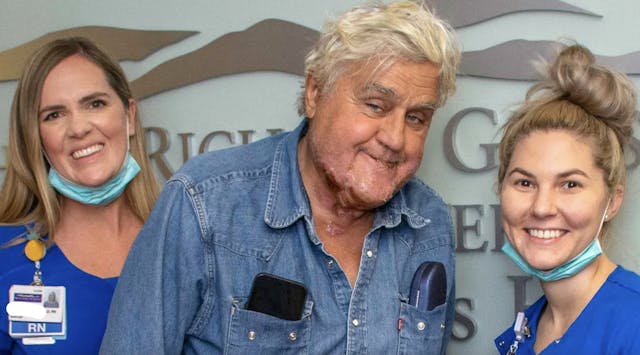 Grossman Burn Center Jay Leno released